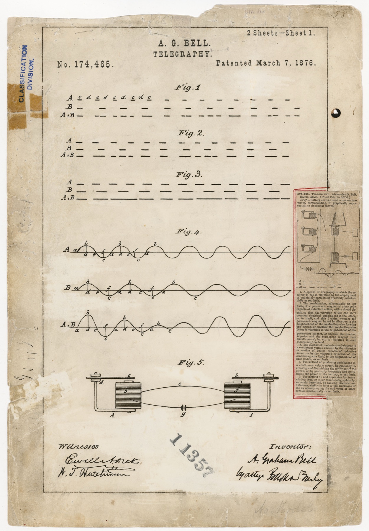 Drawing sheet 1 of US patent 174,465, A. G. Bell, Telegraphy, patented 7 March 1876: five figures of wave diagrams and a circuit, with a clipping pasted on the right edge.